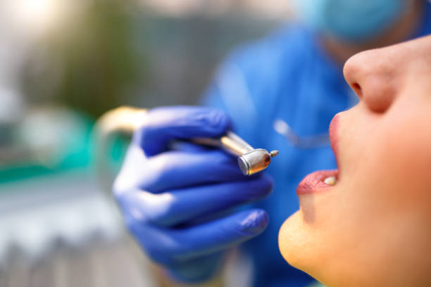 Dental Inlays and Onlays in Tuscarawas, OH